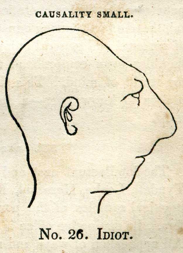 It takes millions to hold us back